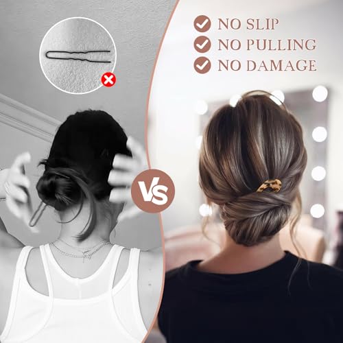 2 Pack Benefree French Style Cellulose Acetate Tortoise Shell U Shaped 4.7 inch Hair Pins Fork 2 Prong Updo Chignon Pin for Women Girls Hairstyle Accessories（Tortoiseshell and White Tortoiseshell) - color: Tortoiseshell&White Tortoiseshell